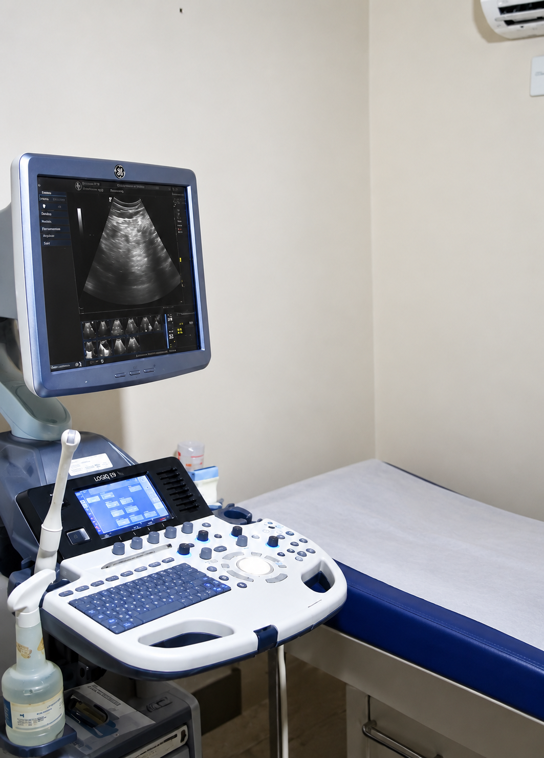 Sala de ultrassonografia da Clínica Amor e Vida, com o equipamento de ultrassom e a maca preparados para o exame